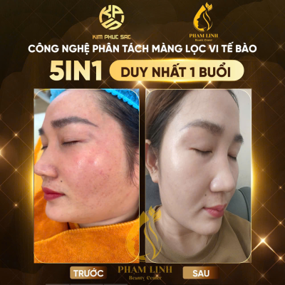 Chăm sóc da tăng sắc tố