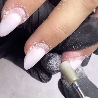 Fill gel/bột